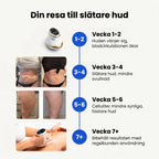 CuppingPro™ | Elektrisk cuppingmaskin för celluliter